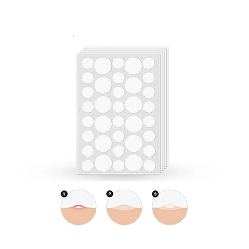 Acne Pimple Patches 72pcs | Hydrocolloid Invisible Spot Treatment